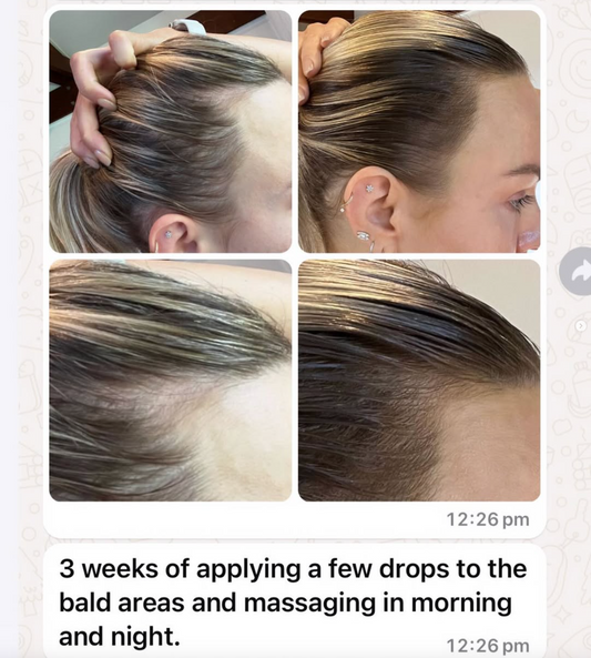Vita-Growth Peptide Scalp Serum